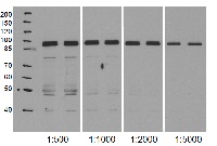 NodGS | Nodulin / glutamate-ammonia ligase-like protein in the group Antibodies Plant/Algal / Nitrogen Metabolism at Agrisera AB (Antibodies for research) (AS15 3030)